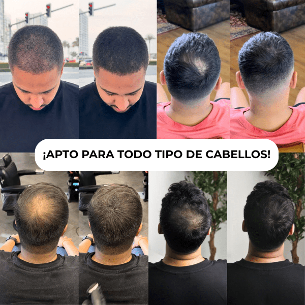 Densificador Capilar HairLuxe™
