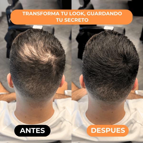 Densificador Capilar HairLuxe™