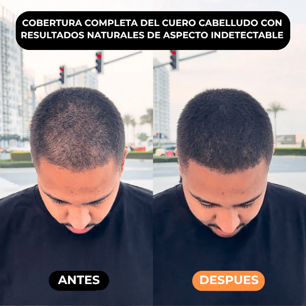 Densificador Capilar HairLuxe™