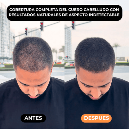 Densificador Capilar HairLuxe™
