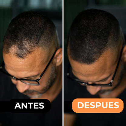Corrector Capilar HairLuxe™