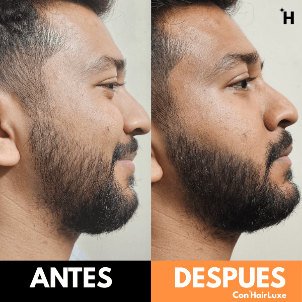 Lápiz corrector de barba HairLuxe™