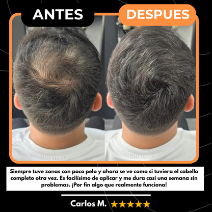 Corrector Capilar HairLuxe™