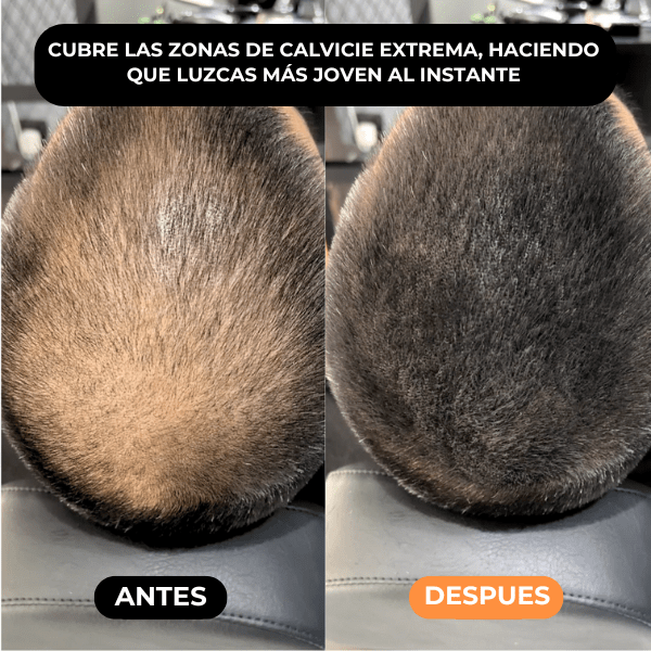 Densificador Capilar HairLuxe™