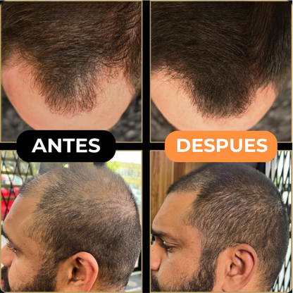 Corrector Capilar HairLuxe™
