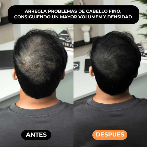 Densificador Capilar HairLuxe™