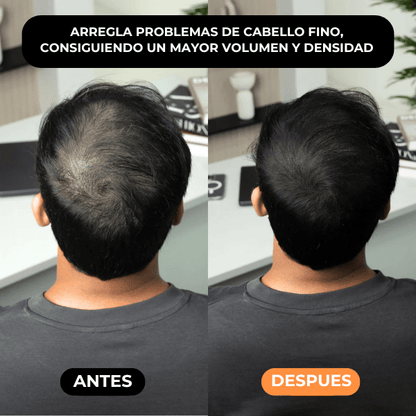 Densificador Capilar HairLuxe™