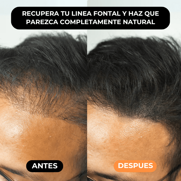 Densificador Capilar HairLuxe™