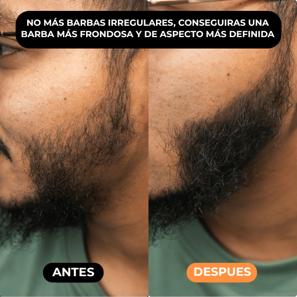 Densificador Capilar HairLuxe™